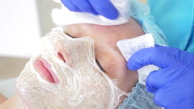 procedure for cleaning the face in the doctor's office of a dermatologist. 4k, close-up, slow-motion . Squeezing the infected pustulous acne to inoculation