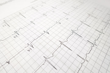 heart test ekg printed graph sheet