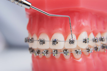 on macro photos shows how the system of brackets is arranged