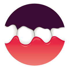 歯ぐきの腫れ　歯周病