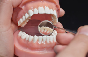 Dental model, observation using dental mirror