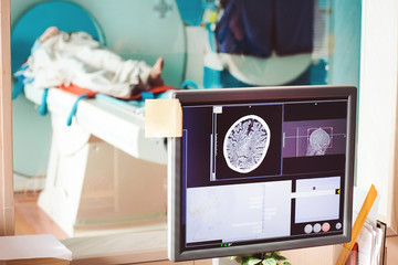 MRI machine and screens with doctor and nurse