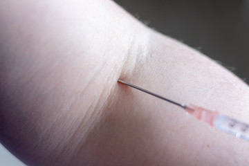 Syringe at the arm of a woman in the hospital