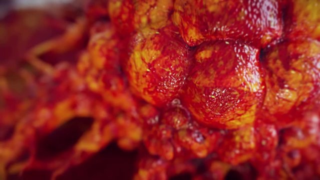 Cancer Cell Animation