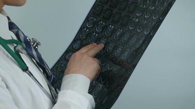 This video features a close-up shot of a male doctor standing at his office, he is holding and analyzing MRI scan of patient`s brain.