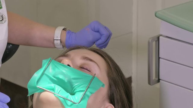 Woman at dentist clinic gets dental treatment to fill a cavity in a tooth. Dental restoration and composite material polymerization with UV light and laser. The doctor works with an assistant.