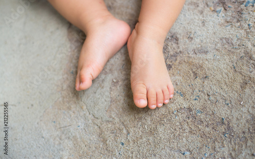 The Foot Of The Child On The Concrete Floor Is Old And