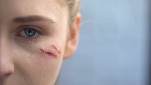 Melancholic woman with scars on face crying and looking into camera, trauma