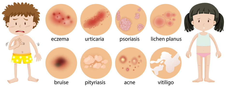 Young children with different skin conditions