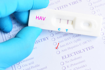 Hepatitis A virus positive test result by using rapid test cassette