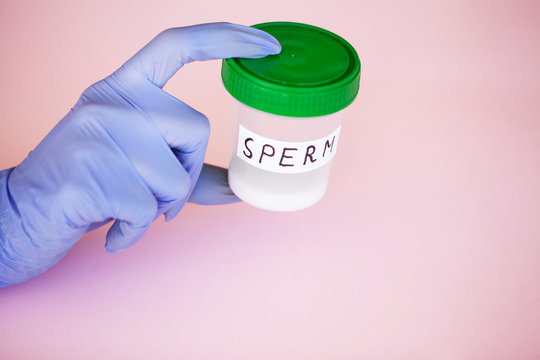 Health. Sperm Analysis. Concept of Bank Sperm. Infertility. Doctor's Hand Holding Container for Analyzes