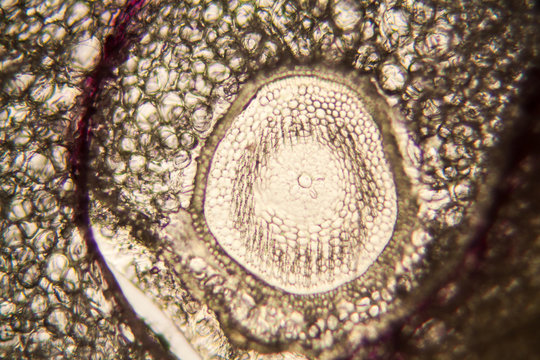 Onion root cells at the microscope 
