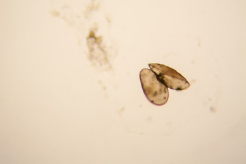 Fresh pond water plankton and algae at the microscope. Ostracod crustacean


