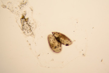 Fresh pond water plankton and algae at the microscope. Ostracod crustacean

