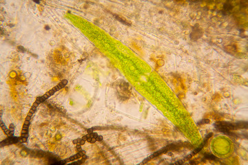 Fresh pond water plankton and algae at the microscope


