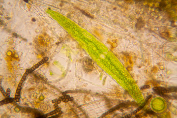 Fresh pond water plankton and algae at the microscope

