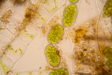 Fresh pond water plankton and algae at the microscope. Spirogyra

