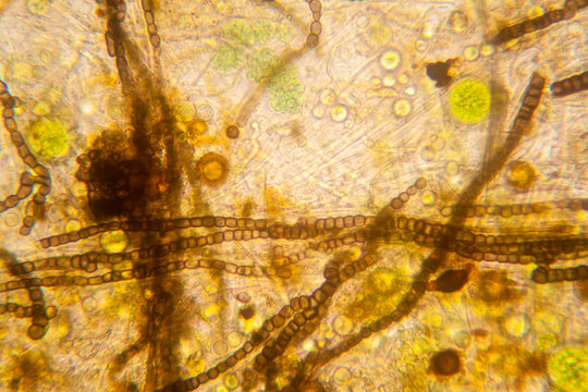 Fresh pond water plankton and algae at the microscope. Nostoc commune

