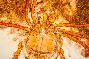 Fresh pond water plankton and algae at the microscope. Pond mite

