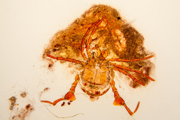 Fresh pond water plankton and algae at the microscope. Pond mite

