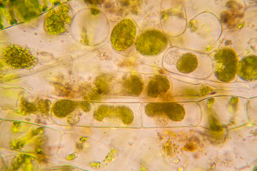 Fresh pond water plankton and algae at the microscope. Spirogyra

