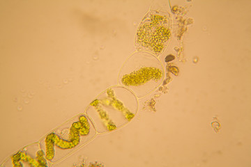 Fresh pond water plankton and algae at the microscope. Spirogyra
