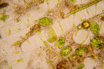 Fresh pond water plankton and algae at the microscope. Spirogyra

