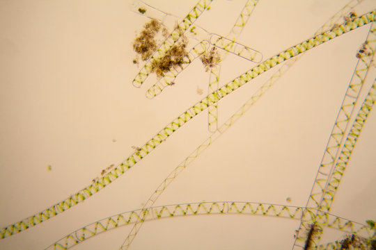 Fresh pond water plankton and algae at the microscope. Spirogyra
