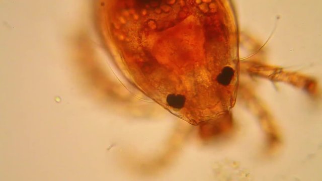 Fresh pond water plankton and algae at the microscope. Pond mite