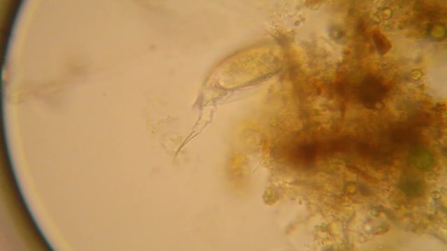 Microscopic view of organisms in the fresh pond water. Rotifers