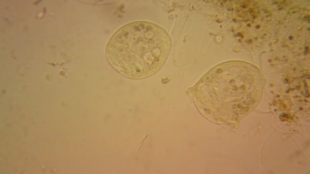 Fresh water plankton and algae at the microscope. Vorticella convallaria and cilliate
