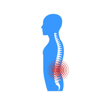 Spine pain. Vector.