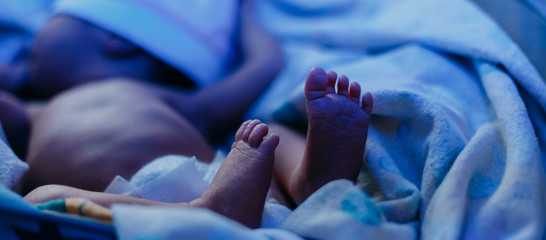 newborn baby lying under blue lamp because of bilirubin, phototherapy, he has jaundice - obrazy, fototapety, plakaty