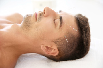 Fototapeta na wymiar Young man undergoing acupuncture treatment in salon, closeup