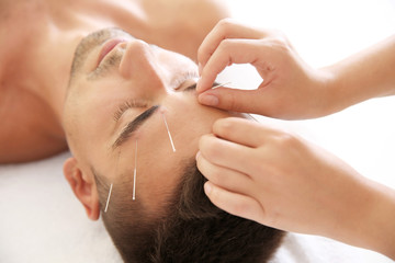 Young man undergoing acupuncture treatment in salon, closeup - obrazy, fototapety, plakaty
