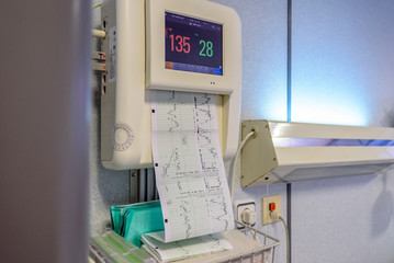 Electrocardiograma con gráficas de mujer de parto 03