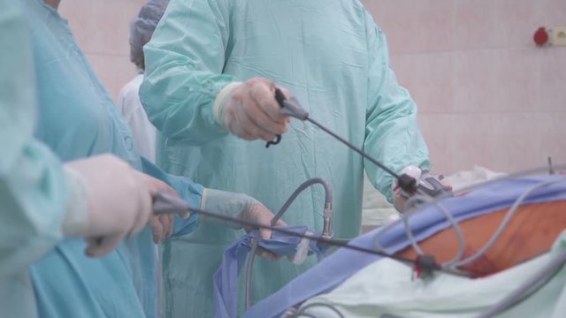 The surgeon performs an endoscopic operation on the organs of the abdominal cavity