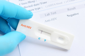 HIV Negative test result by using rapid test cassette