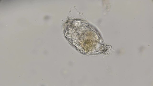 egg creeping Rotatoria under a microscope