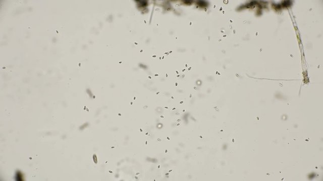 colony of the simplest microorganisms including parasites under a microscope