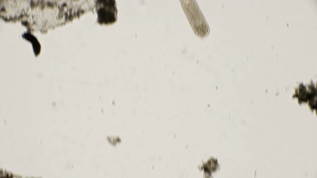 ciliated flat worm under a microscope