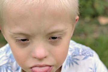Defect,childcare,medicine and people concept- boy with down syndrome poses for a portrait outdoors.