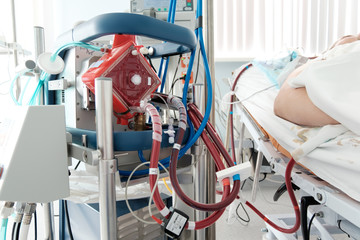 working ecmo machine in intensive care department