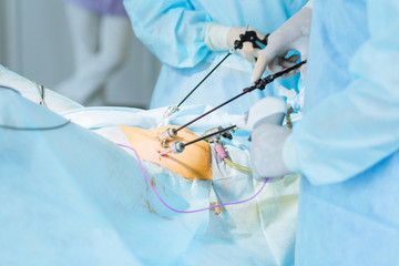 Close up of hands of surgeons team during operation uterus removal with surgical laparoscopy...