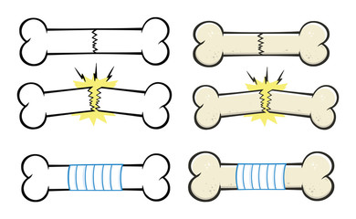Bone Fracture Line Cartoon Drawing Design Set 3. Vector Collection Isolated On White Background