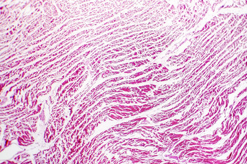 Brown atrophy of the heart, light micrograph, photo under microscope