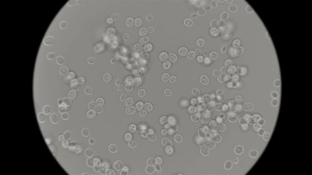 yeast is moving under the microscope