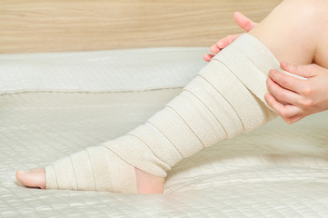Woman applying elastic compression bandage after varicose surgery