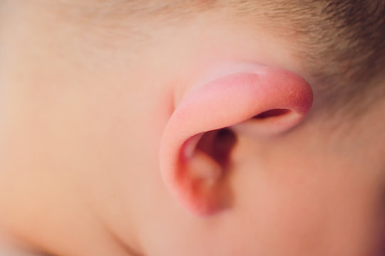 Baby ear is swollen, red, warm touch because mosquito bites. Mosquito or insects feast on our blood and then leave a residual saliva on the skin that causes itchy.
