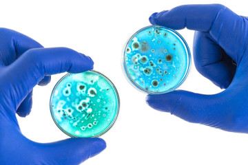 hand in blue glove holds petri dish with agar and bacterium colony, isolated